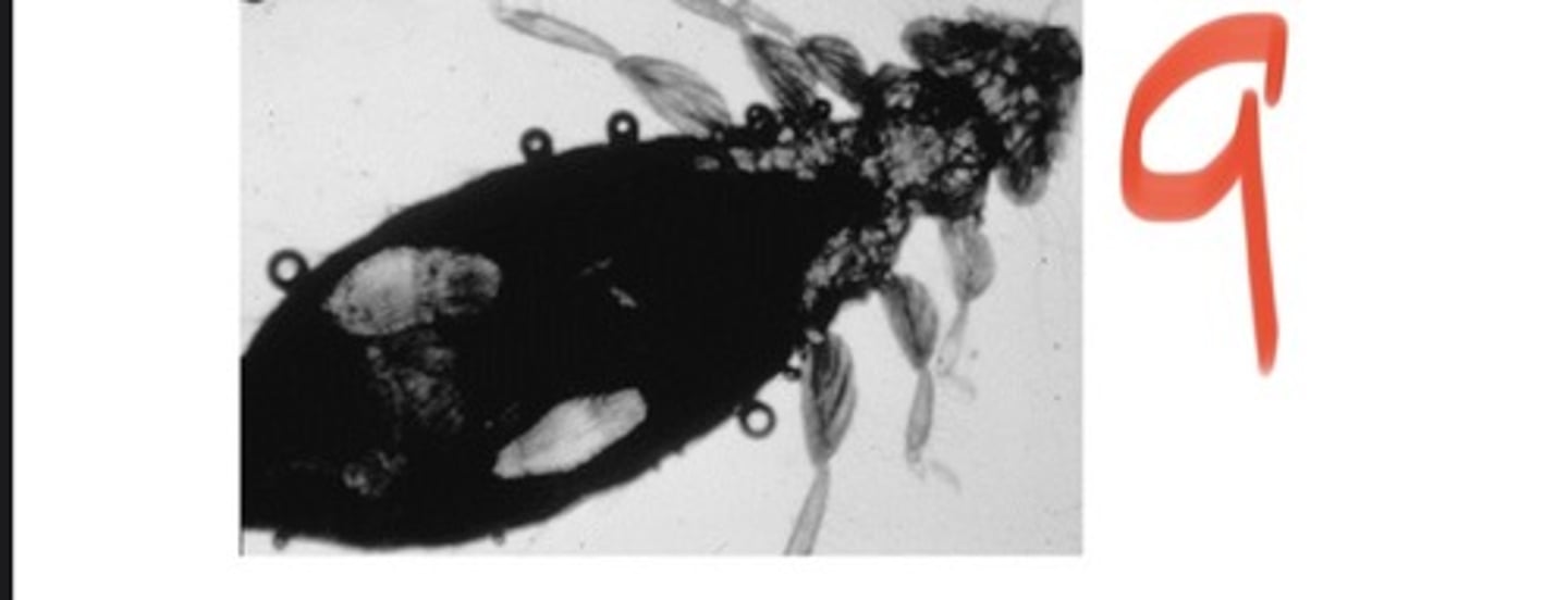 <p>This louse of birds is an ___ species of louse</p>