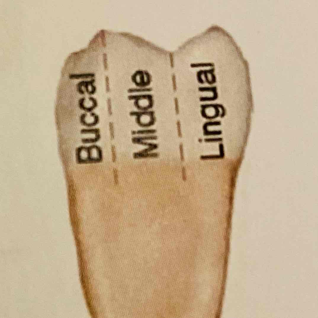 <ul><li><p>Buccaal (wangzijde)</p></li><li><p>Midden</p></li><li><p>Linguaal (tongzijde)</p></li></ul>