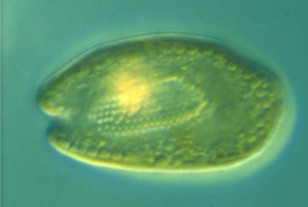 <p>What phytoplankton is this?</p>