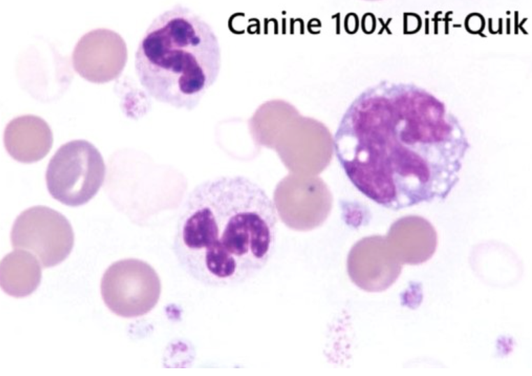 <p>Identify all RBC morphologies in the photo </p>