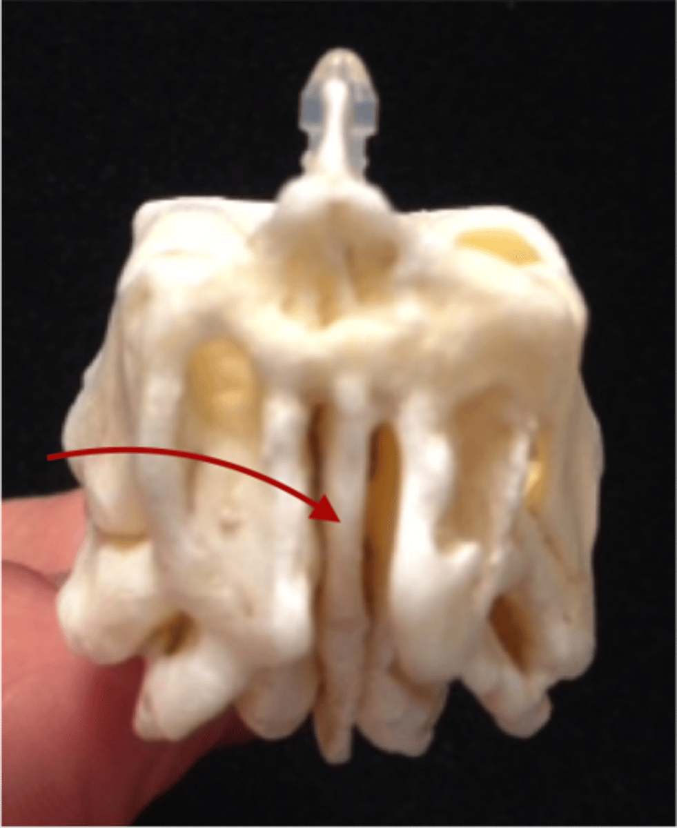 <p>structure</p><p>anterior ridge to the crista galli sown the center</p>