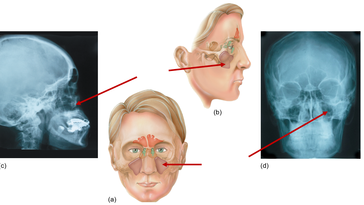 <p>Next to nose, under eyes, maxilla</p>
