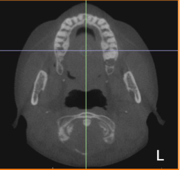 <p>what plane is this </p>