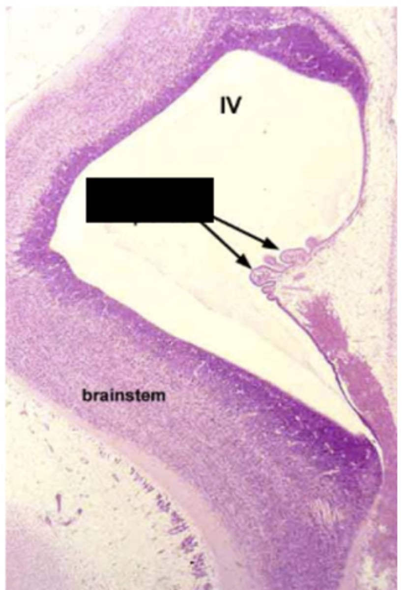 <p>Identify the structure</p>