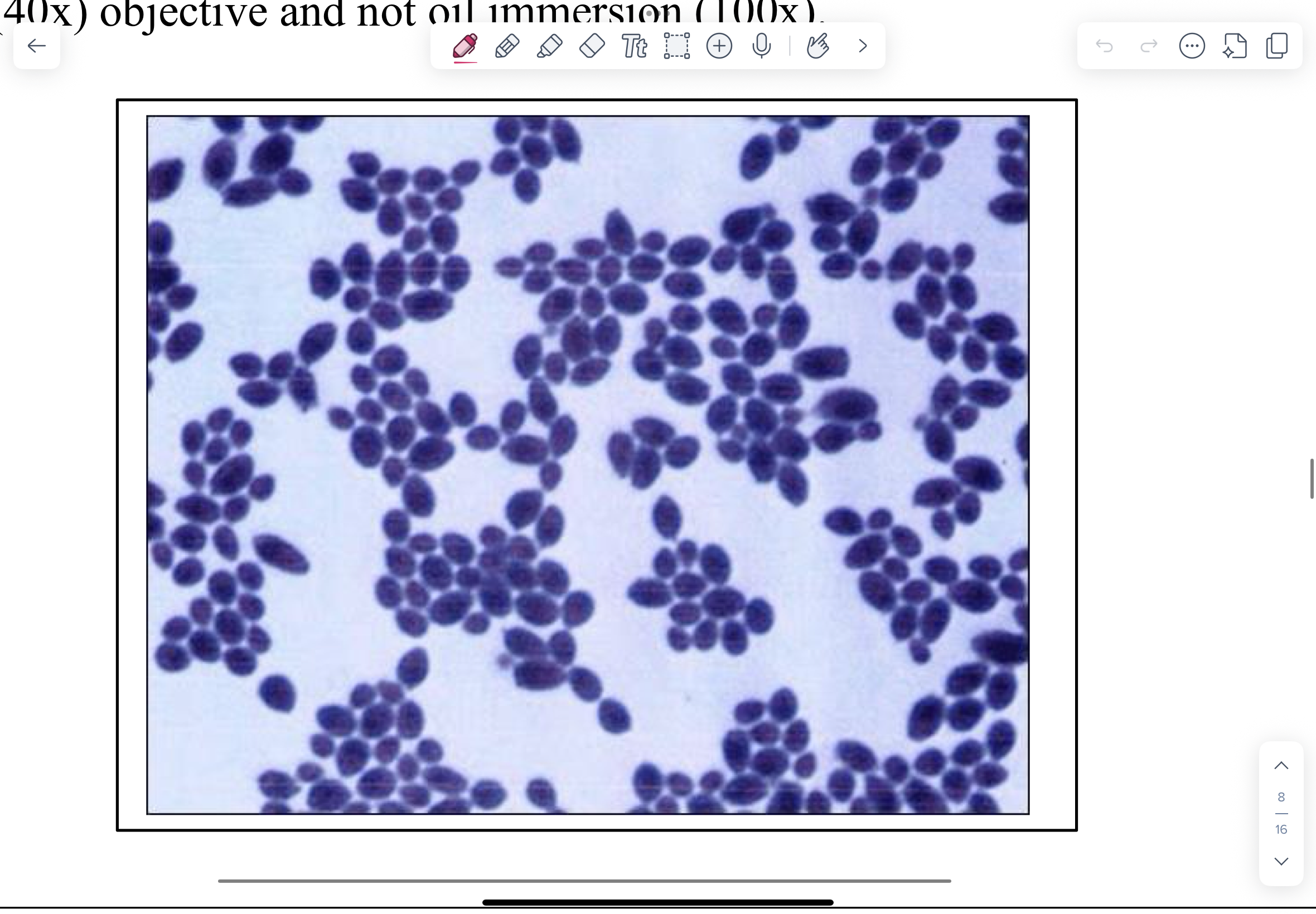 <p>NOTE blue budding yeast (3.0-5.0 µm) with daughter cell connected by a narrow base. The occasional short hyphae may be present. You might mistake these for large gram-positive cocci. Keep in mind that you are on the high-dry (40x) objective and not oil immersion (100x).</p>
