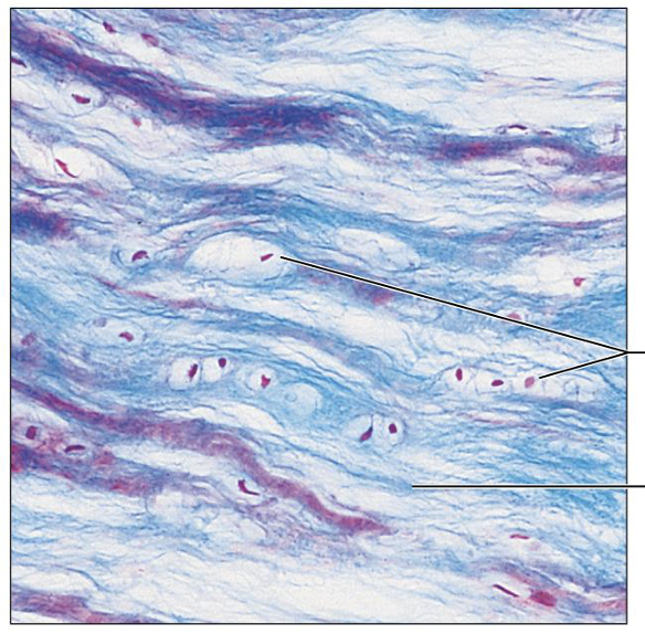 <p>What is this tissue, and where is it found?</p>