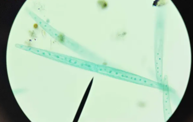 <p>What is closterium’s body form and environment?</p>