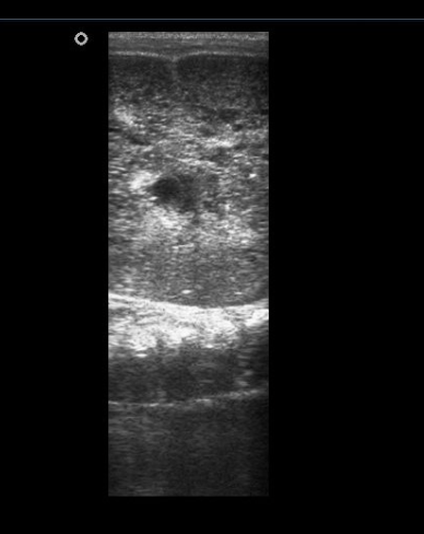 <p>Diagnostic findings in ARPKD</p>
