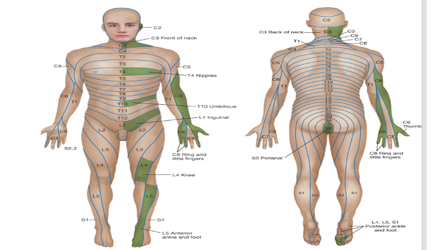 <ul><li><p><span><span>T4= nipple</span></span></p></li><li><p class="MsoNormal"><span><span>T10= umbilical</span></span></p></li><li><p class="MsoNormal"><span><span>L1= ‘hands in pockets’</span></span></p></li><li><p class="MsoNormal"><span><span>L4= knee</span></span></p></li></ul><p></p>