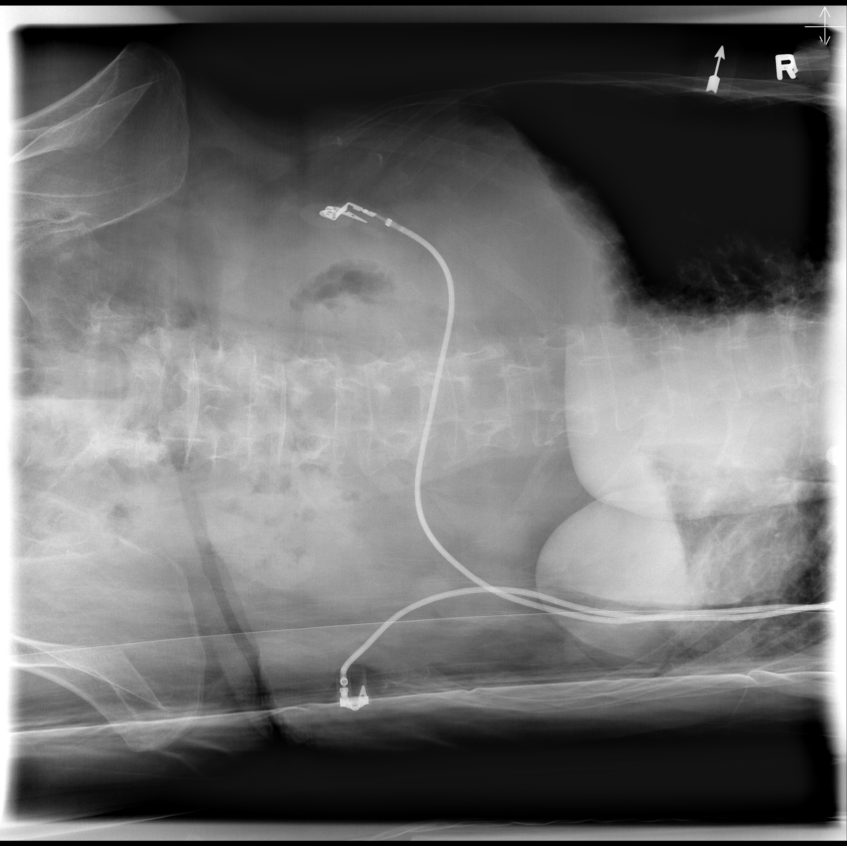 <p><span><strong>Assess thorax rotation</strong></span></p>