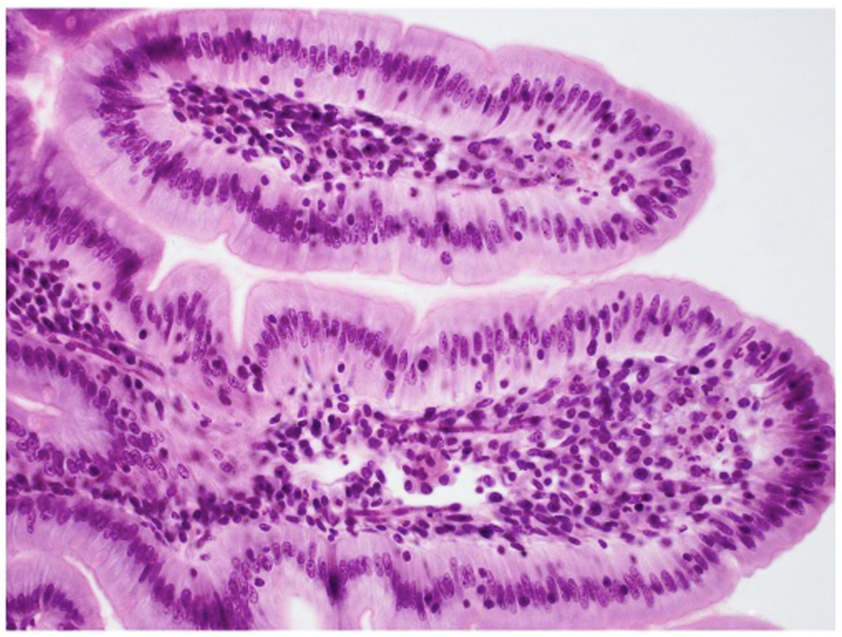 <p>Simple columnar epithelium.</p>