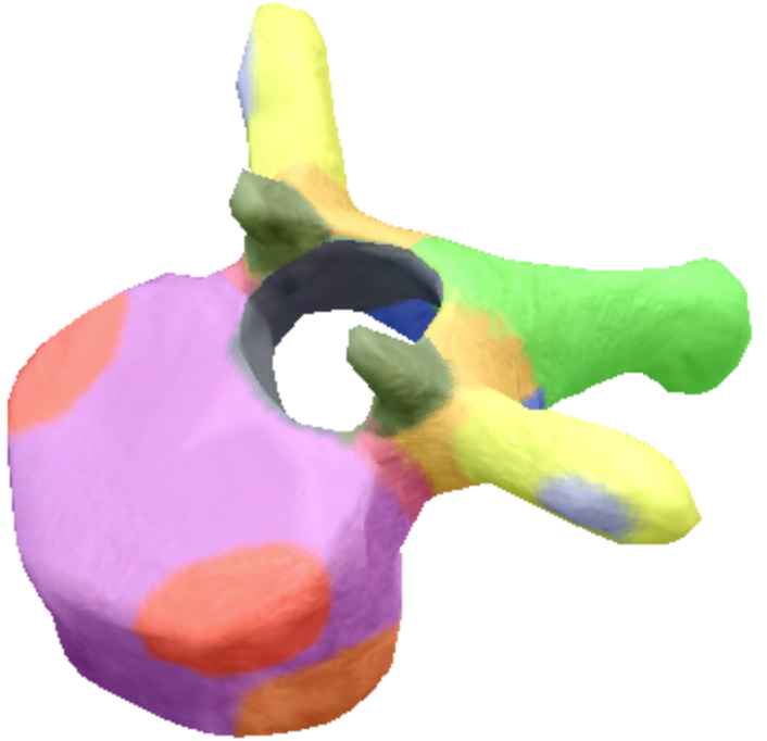 <p>Where are the transverse processes located on the thoracic spine vertebra?</p>