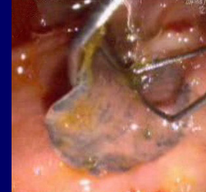 <ul><li><p>Flat, bilateral symmetry</p></li><li><p>Most are hermaphroditic</p></li><li><p>Leaf-shaped or slender</p></li><li><p>Suckers, hooks (attachment)</p></li><li><p>≥ 1 mollusk intermediate host</p></li><li><p>Simple digestive tract</p></li></ul><p></p>