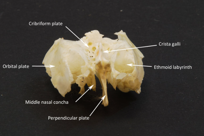 <p>inferior projection that articulates with vomer to form nasal septum</p><p></p>