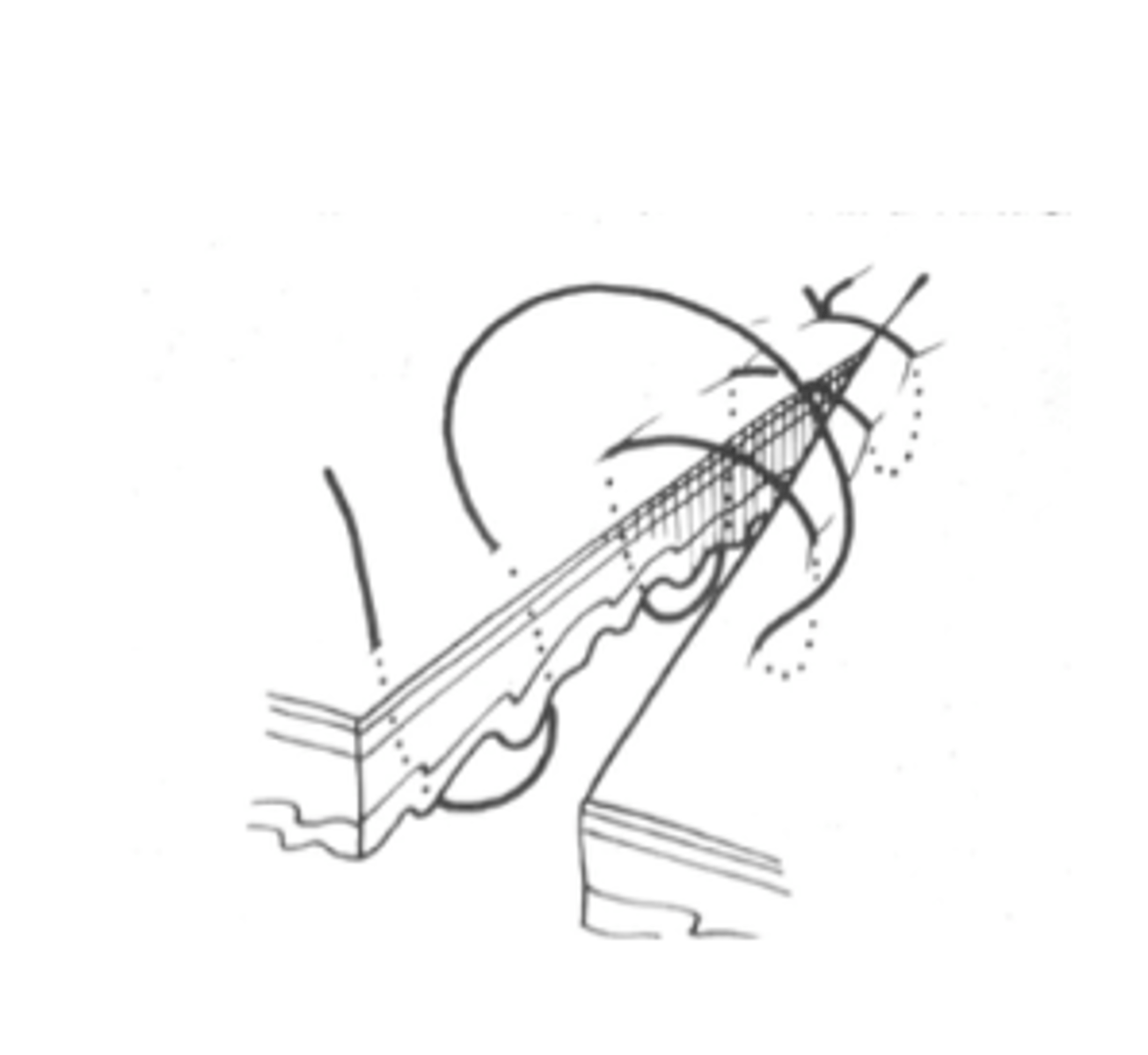 <p>- Bites on each side of the incision, parallel to the incision, pass into serosa, through muscularis and deep to submucosa, then into the lumen and back out.</p>