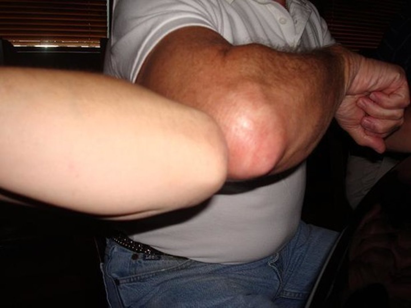 <p>DEFINITION</p><p>elbow(s)</p>