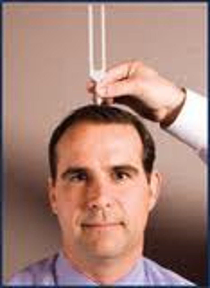 <p>Test done by placing the stem of a vibrating tuning fork on the midline of the head and having the patient indicate in which ear the tone can be heard.</p>
