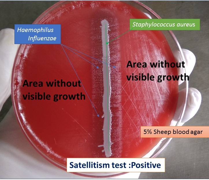 <p>Staphylococcus aureus <em>(H. flu needs help to grow - so it follows staph’s glow!)</em></p>