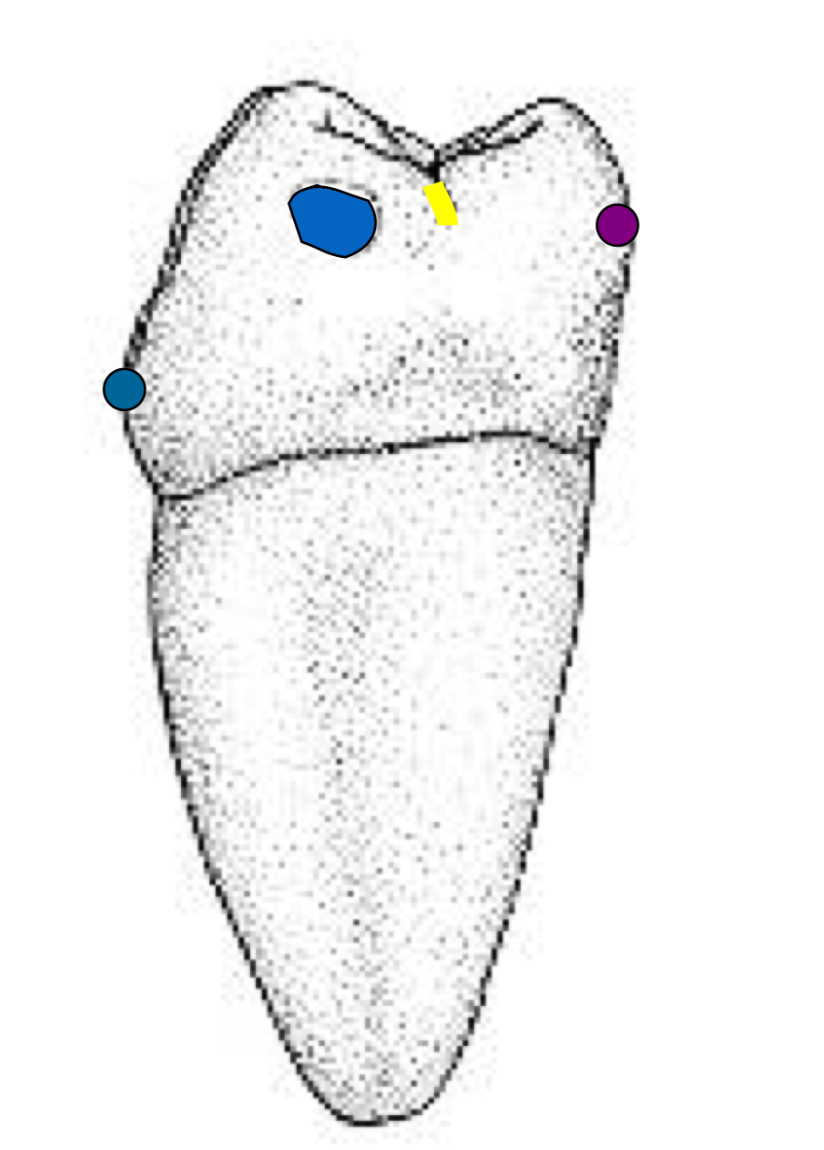 <p>Name the tooth and hi-lighted portions</p>