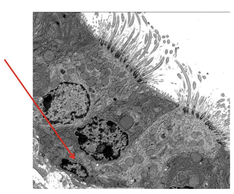 <p>In the attached EM, the cell indicated by the arrow is most likely which of the following?</p>