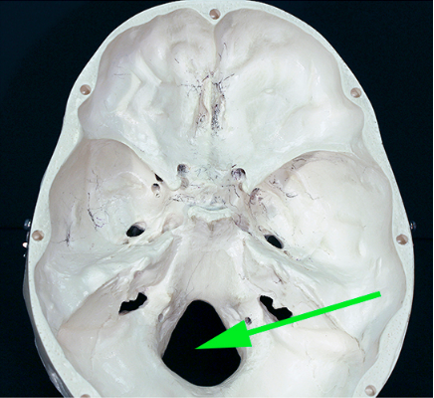 <p>What is the opening marked by the green arrow?</p>