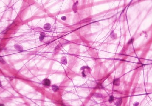 <p>Пухка (аеолярна) сполучна тканина</p>