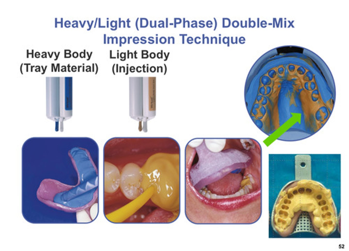 <p>place heavy body in tray and light body on teeth, then take impression </p>
