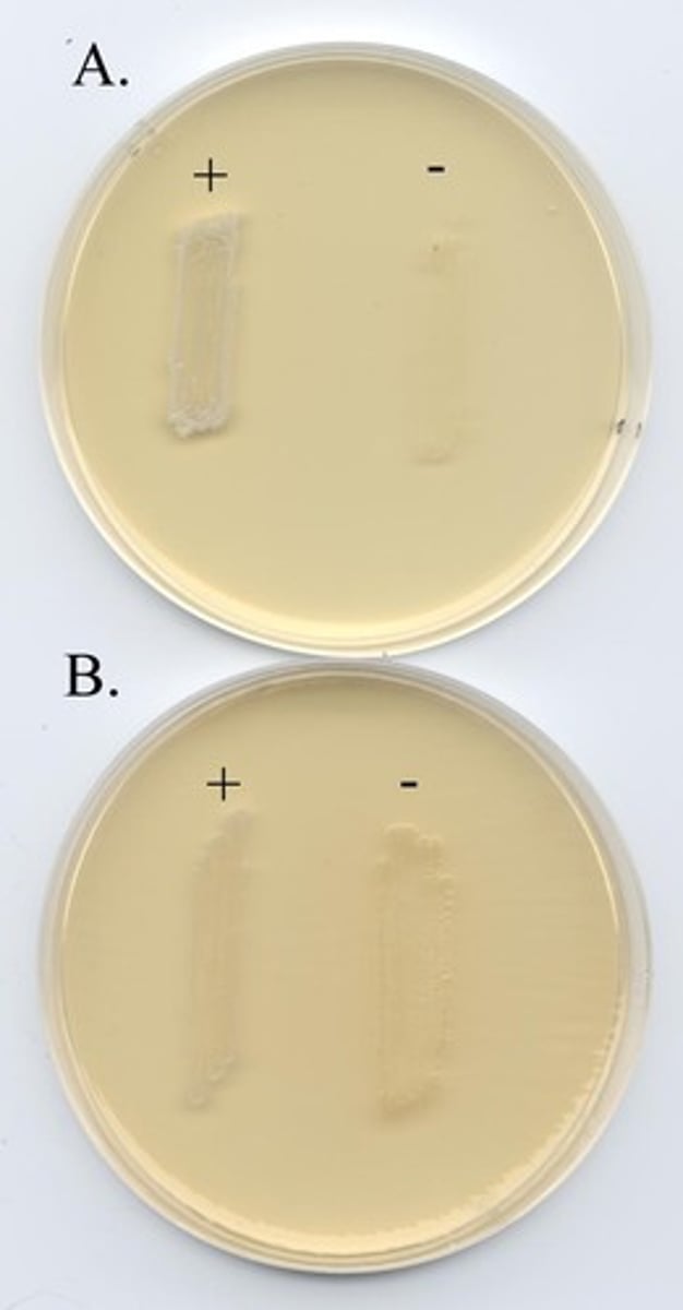 <p>used for isolation/selection of most gram positive bacteria; inhibits most gram negative bacteria</p>