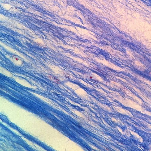 <p>What kind of Cartilage is this?</p>