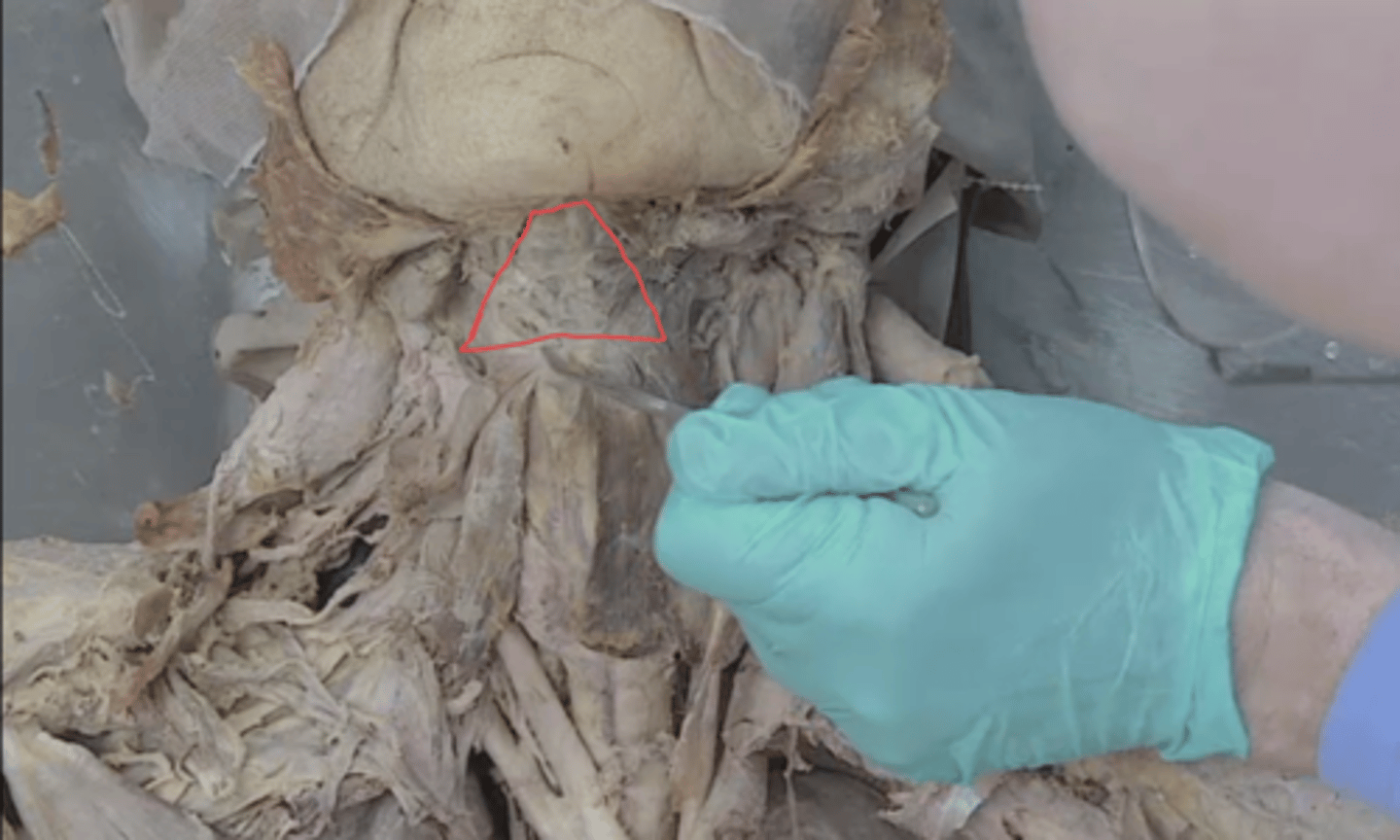 <p>identify this triangle</p>