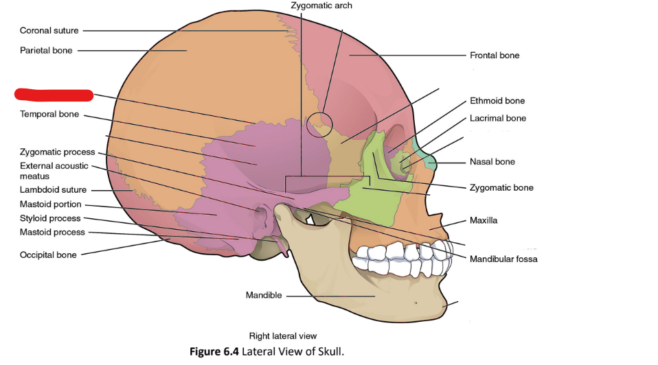 term image