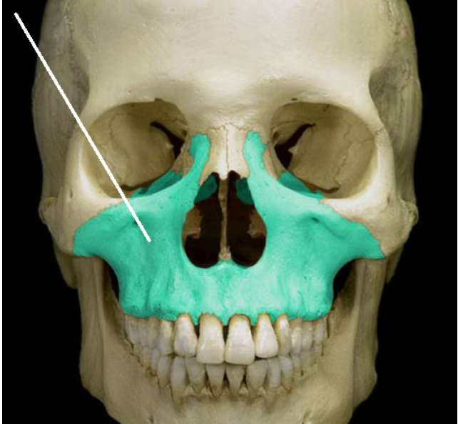 Identify the bone highlighted in green