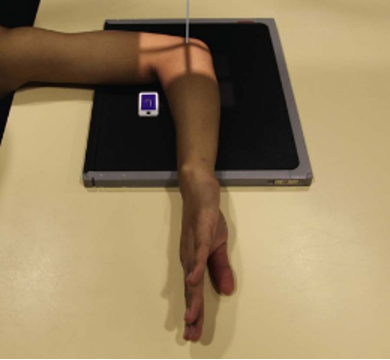 <p>What position would the radial tuberosity face for this position?</p>