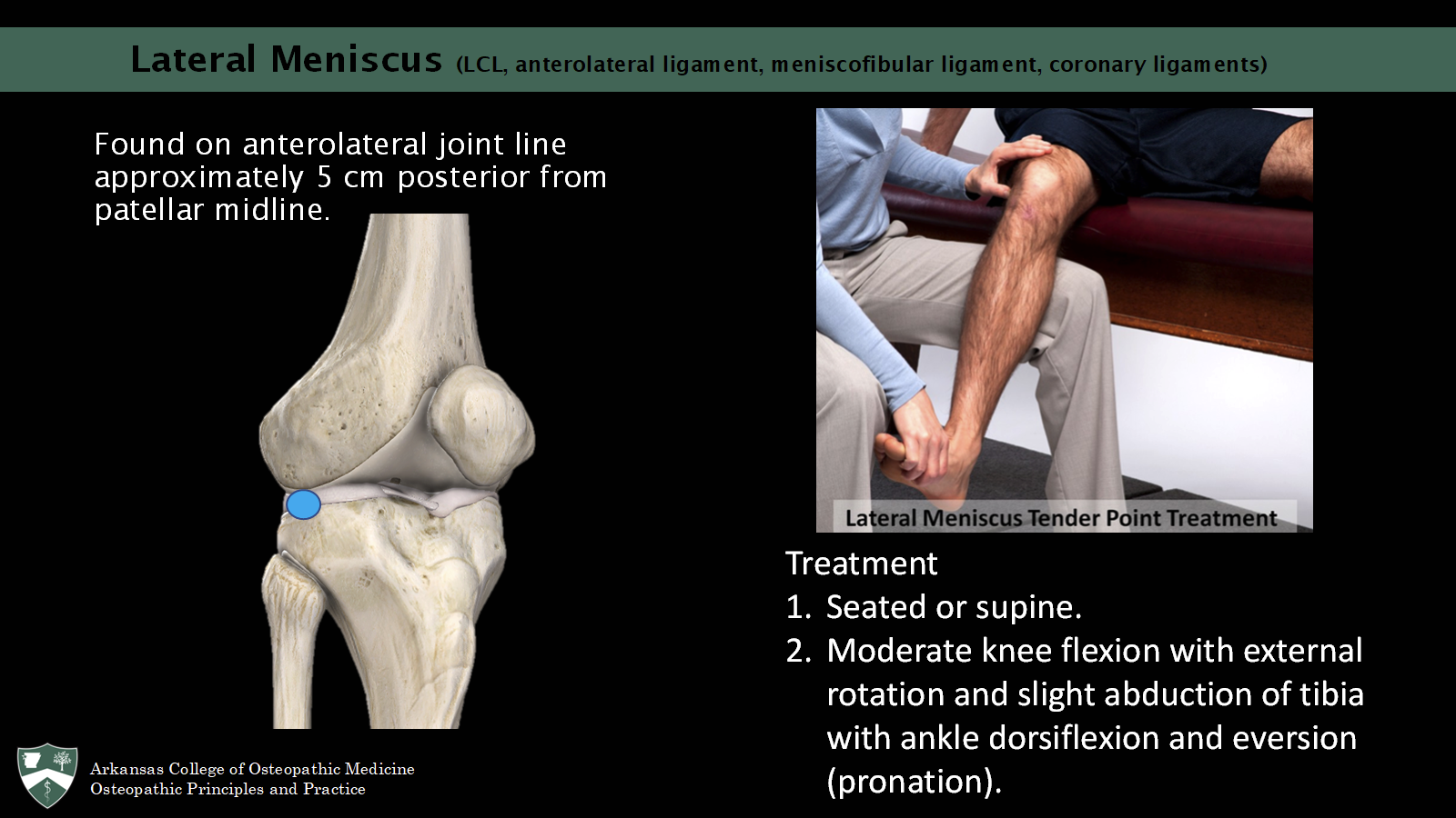 <p><span>Found on anterolateral joint line approximately 5 cm posterior from patellar midline.</span></p><p><span>Seated or supine.</span></p><p><span>Moderate knee flexion with external rotation and slight abduction of tibia with ankle dorsiflexion and eversion (pronation). </span></p>