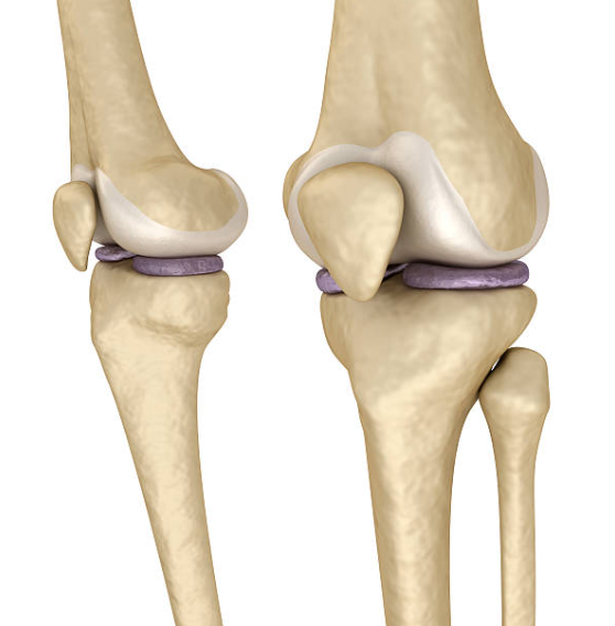 <p>What bone is this?</p>