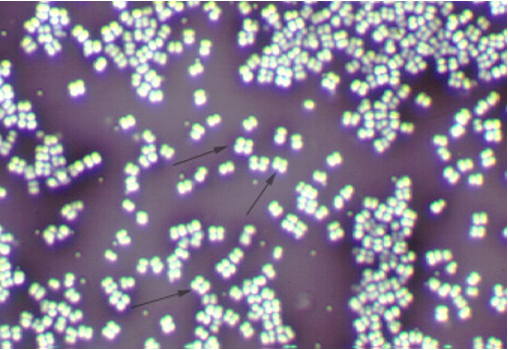 <p>what type of staining procedure in the picture</p>