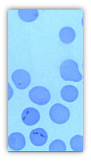 <p>Babesia bigemina</p>