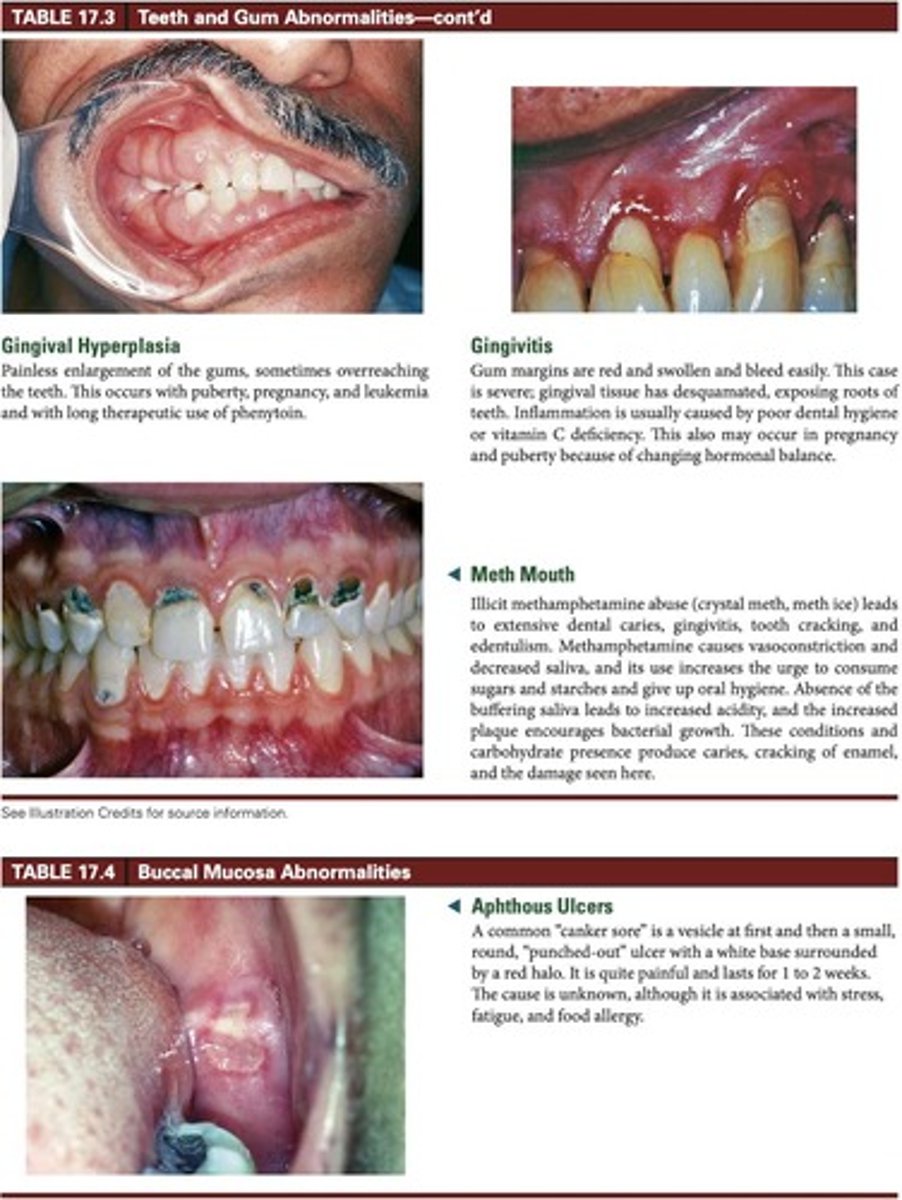 <p>Inflammation of gums, can relate to various factors.</p>