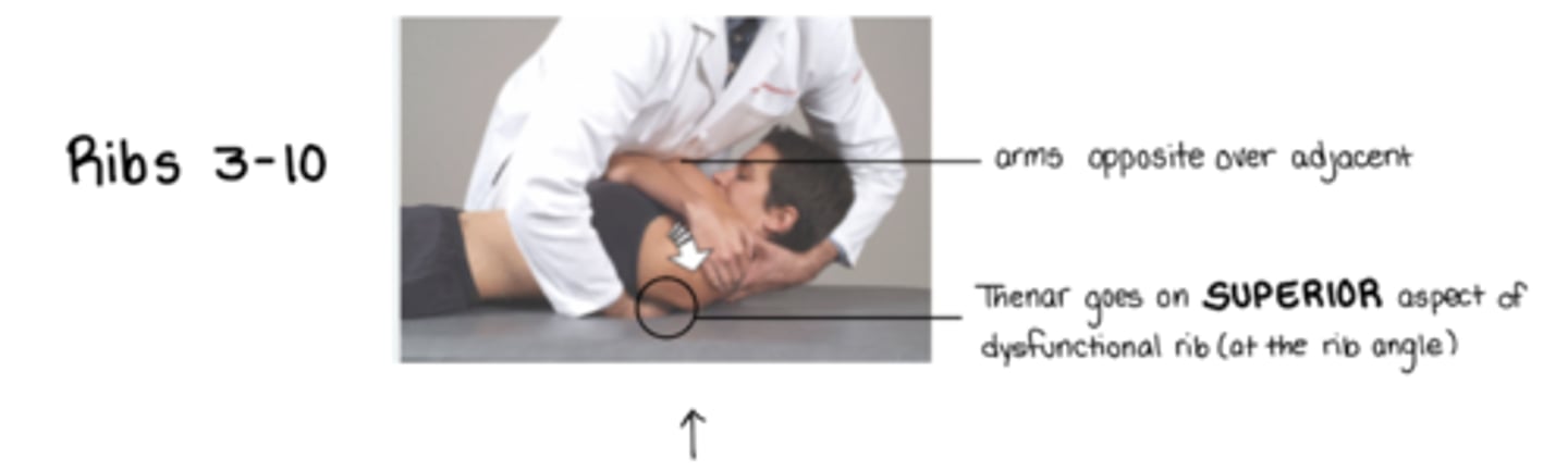 <p>pt arms FAR/NEAR</p><p>stand on OPPOSITE side of dysfunctional rib </p><p>thenar eminence on superior angle of dysfunctional rib at the rib angle</p><p>ribs stuck UP</p><p>(basically thoracic HVLA other than hand placement)</p>