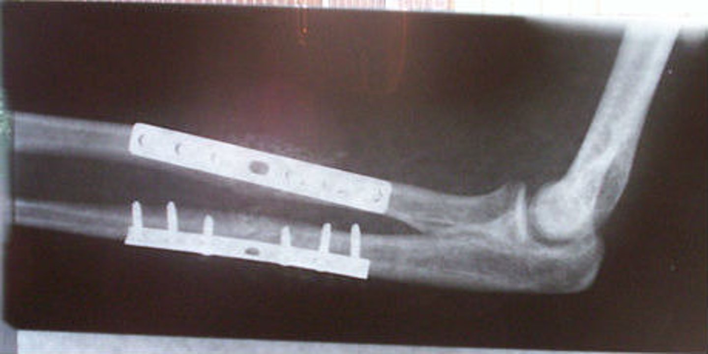 <p>to put in place</p>