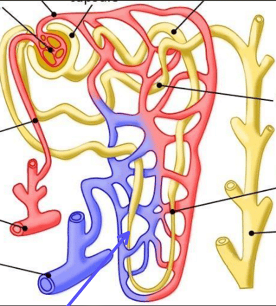 <p>What is the arrow pointing at?</p>