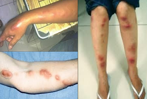 <p>transport WBCs in the body, rid body of toxins (something follows the lymph nodes) </p>