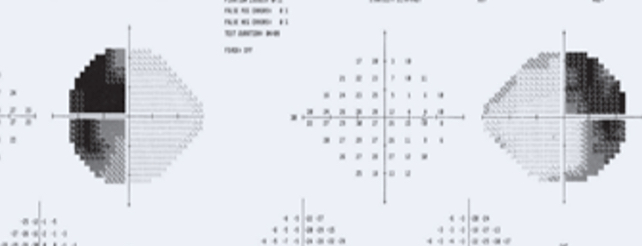 <p>What is this VF plot showing</p>