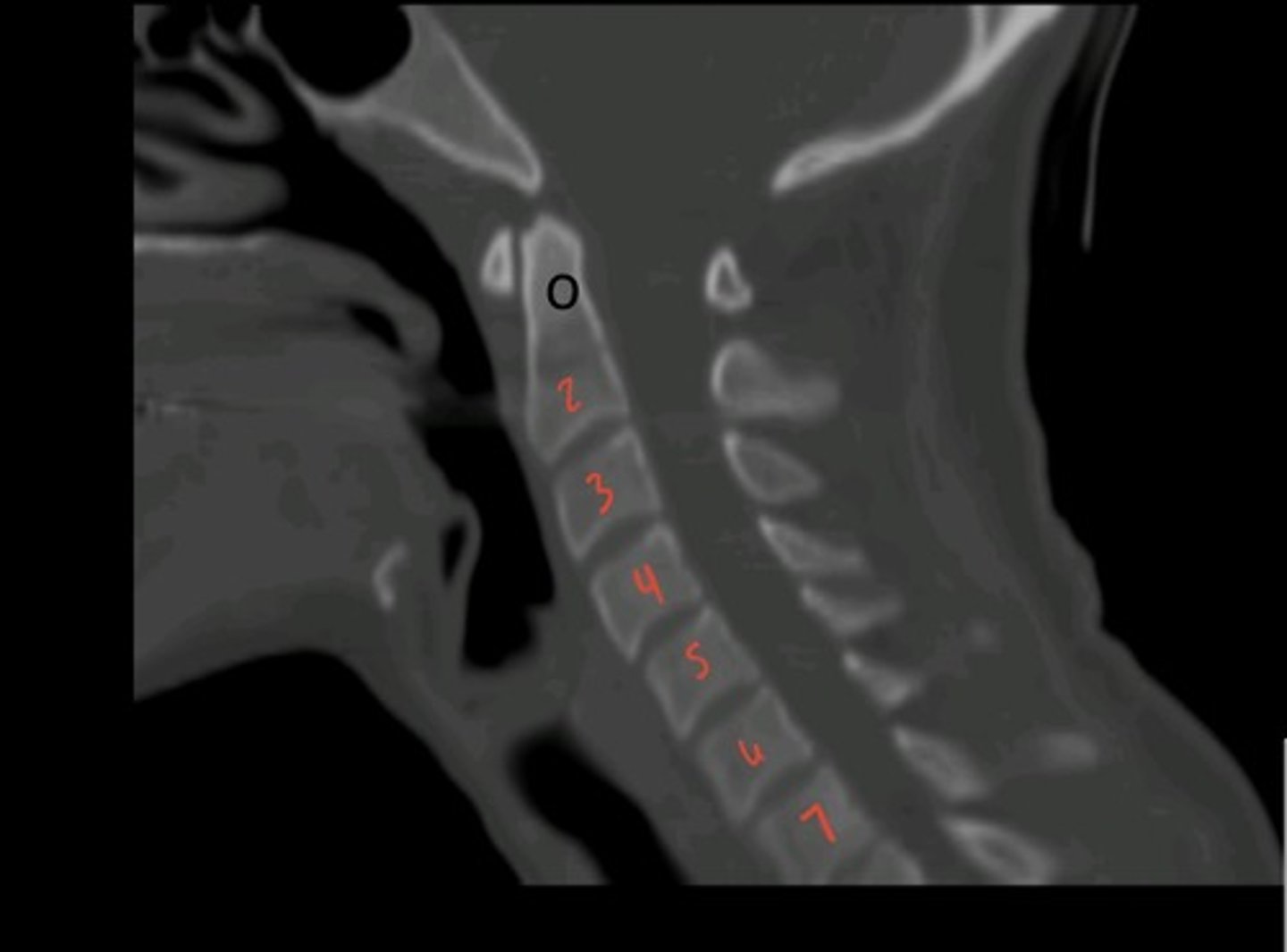 <p>what is this image?</p>