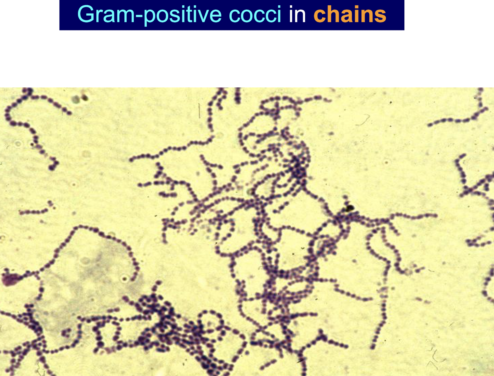 <p><strong><mark data-color="purple" style="background-color: purple; color: inherit;">• Gram positive oval or spherical cocci in pairs </mark></strong><mark data-color="purple" style="background-color: purple; color: inherit;">(diplococci) </mark><strong><mark data-color="purple" style="background-color: purple; color: inherit;">or chains </mark></strong><mark data-color="purple" style="background-color: purple; color: inherit;">that divide in a singular plane</mark></p><img src="https://knowt-user-attachments.s3.amazonaws.com/65259349-fb89-4c9c-9f3b-38bad2f93c31.png" data-width="50%" data-align="center"><p>• 0.5 to 1.0µm.</p><p><strong>• Blood agar</strong> – <strong>show haemolysis.</strong></p><p><strong>• Small colonies  </strong>(0.5-2.0mm), grey to greyish white.</p><p><strong>• Catalase negative.</strong></p>