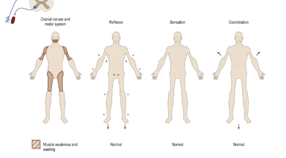<ul><li><p>Many different patterns exist</p></li><li><p>General pattern is proximal weakness (might cause difficulty getting up from a chair for example)</p></li><li><p>Fatiguability is not seen</p></li><li><p>Reflexes are generally preserved</p></li><li><p>Sensation is normal</p></li><li><p>Characteristic regions of atrophy (or hypertrophy)</p></li><li><p>Contractures</p></li><li><p>Pain</p></li><li><p>Dysmorphic features</p></li></ul><p></p>