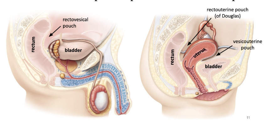 <p>peritoneum drapes over pelvic structures to form pouches</p>