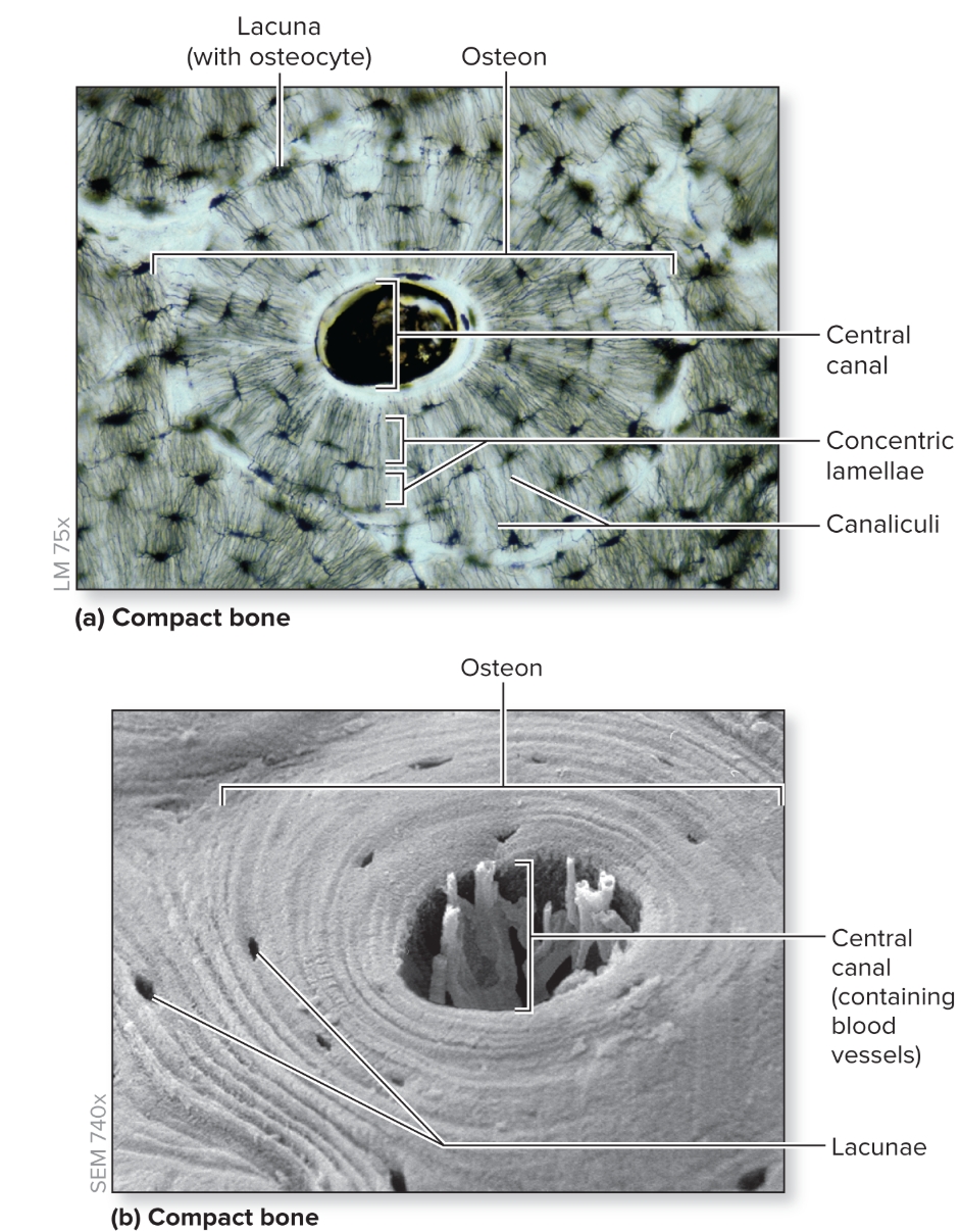 <p>What is compact bone?</p>