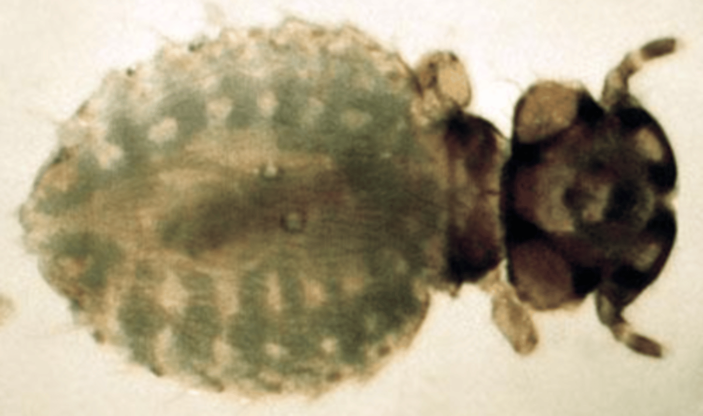 <p>what ectoparasite is seen in this image?</p>
