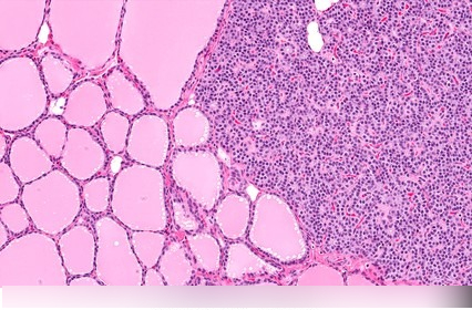 <p>Parathyroid Gland</p>